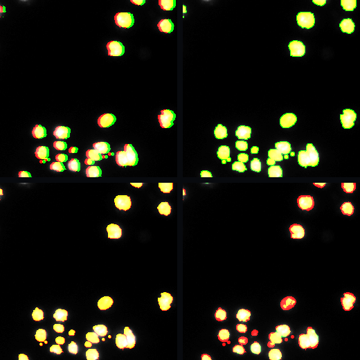 Four segmentation overlays for one BBBC038 sample.